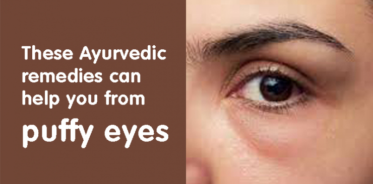 ayurvedic remedies can help you from puffy eyes